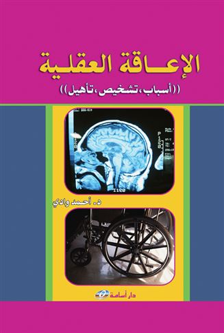 الإعاقة العقلية : أسباب - تشخيص - تأهيل